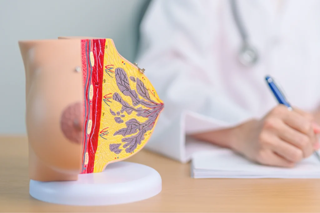Cancer du sein et reconstruction mammaire